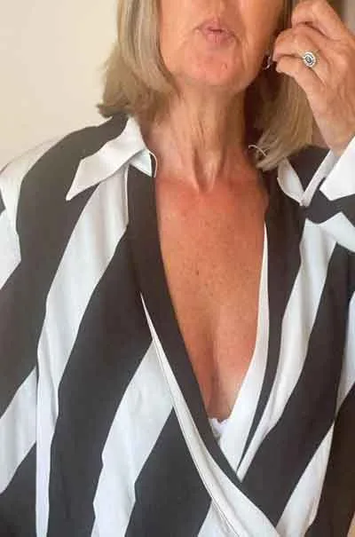 Bente Skarnes
